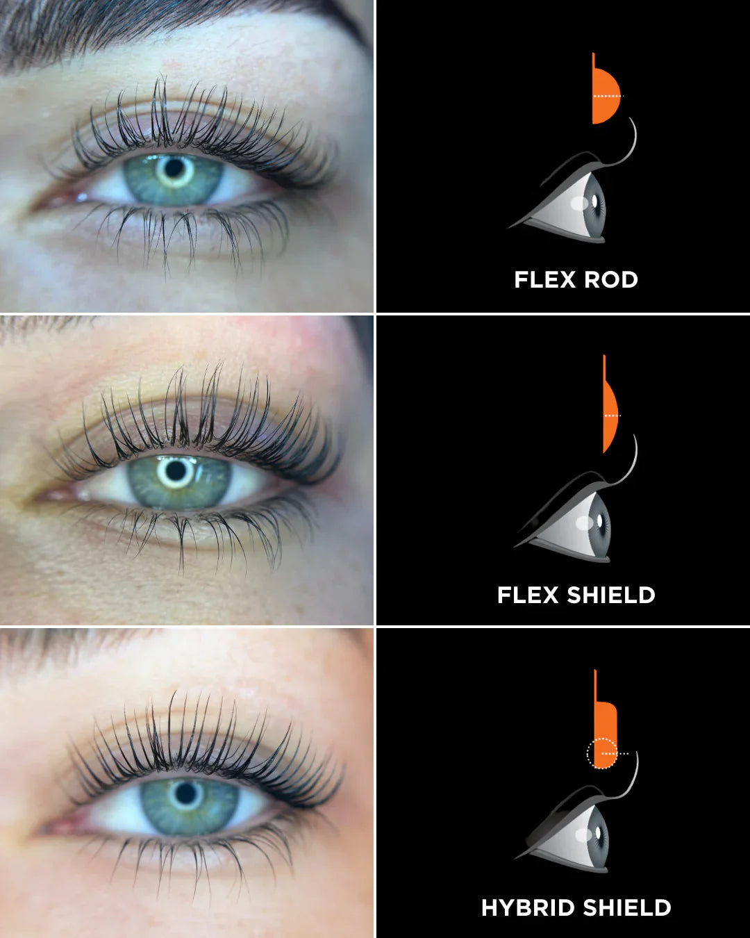 Rod vs Shield vs Hybrid?